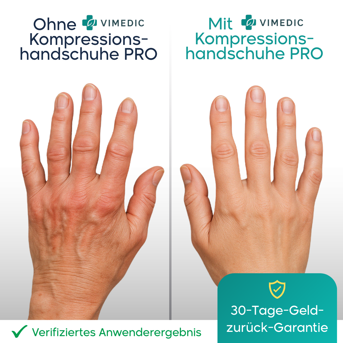 Vimedic Kompressions-handschuhe PRO