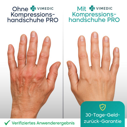 Vimedic Kompressions-handschuhe PRO